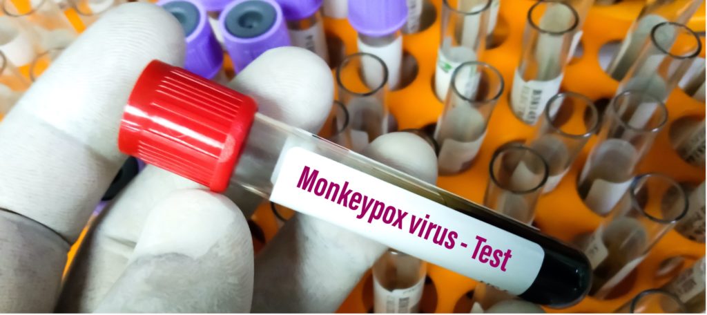 Monkeypox virus test